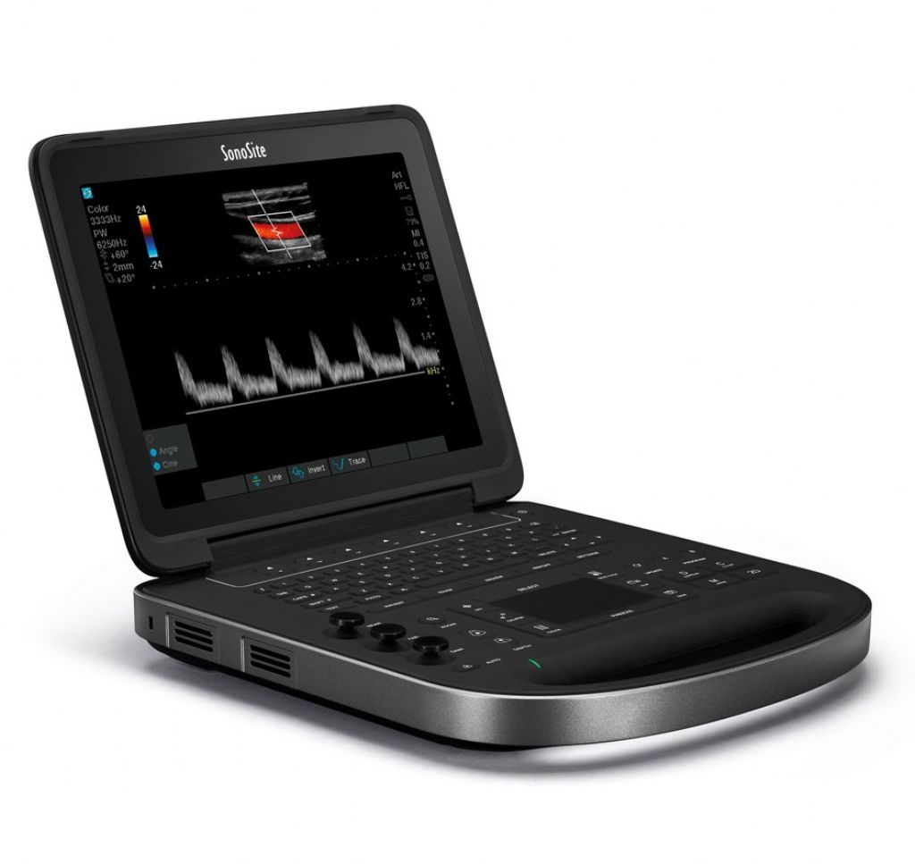 FUJIFILM SONOSITE EDGE II VET RENKLİ DOPPLER ULTRASON CİHAZI