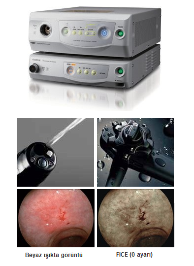 data-cke-saved-src=/dosyalar/images/fujifilm%2DEPX3500HD%2Dendoskopi%2Dsistem%2Dveteriner.png