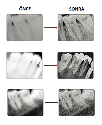 data-cke-saved-src=/dosyalar/images/hdr%2D600%2Dveteriner%2Ddental%2DDR%2Dsistemi%2Dhasvet.png