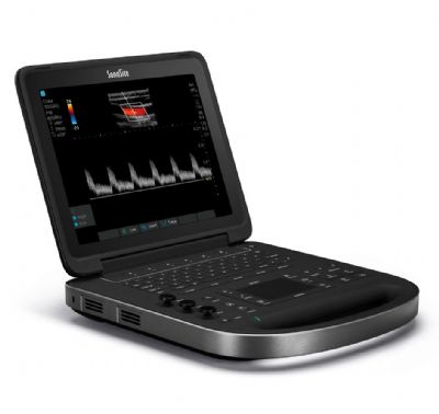 FUJIFILM SONOSITE EDGE II VET RENKLİ DOPPLER ULTRASON CİHAZI