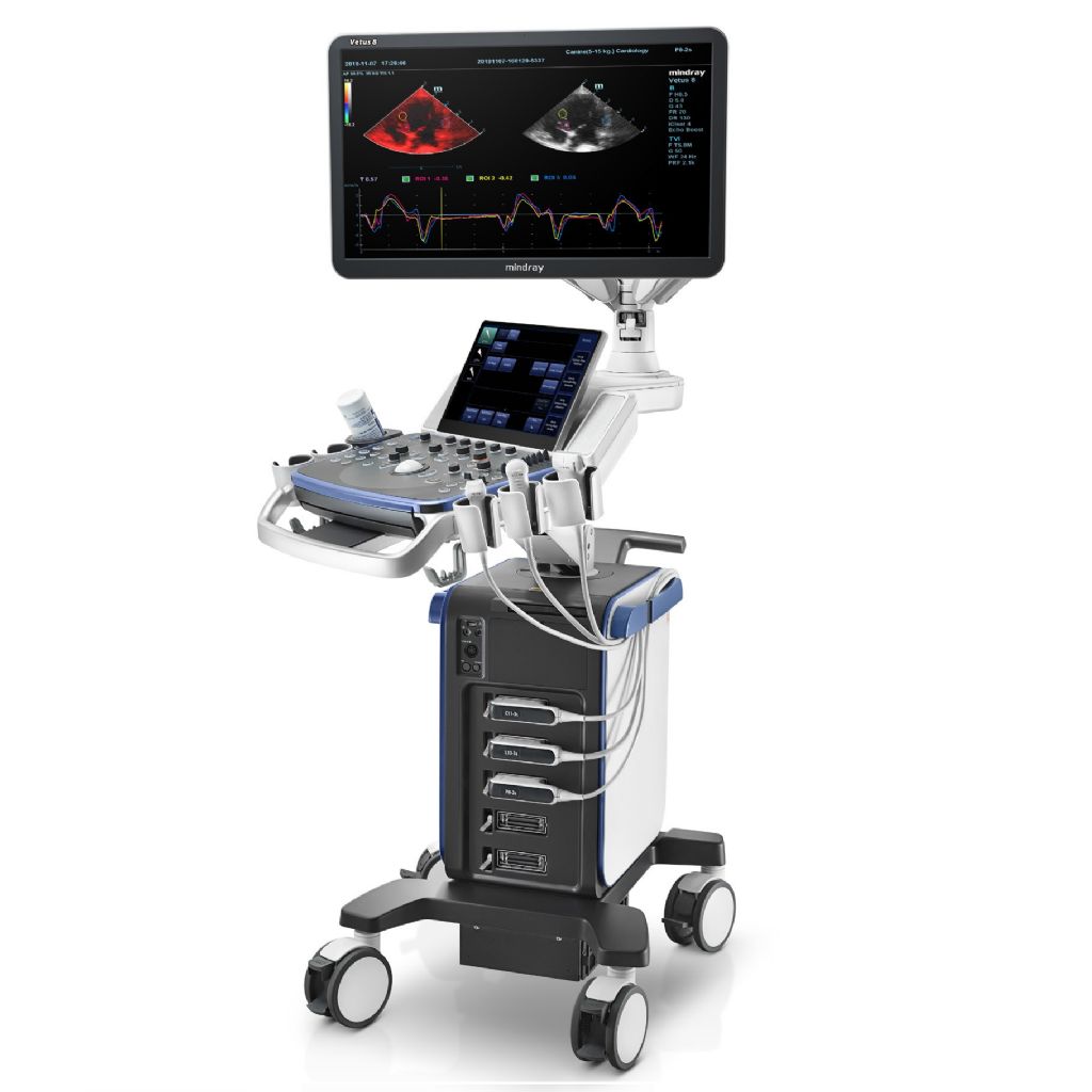 MINDRAY VETUS 8 RENKLİ DOPPLER ULTRASON CİHAZI