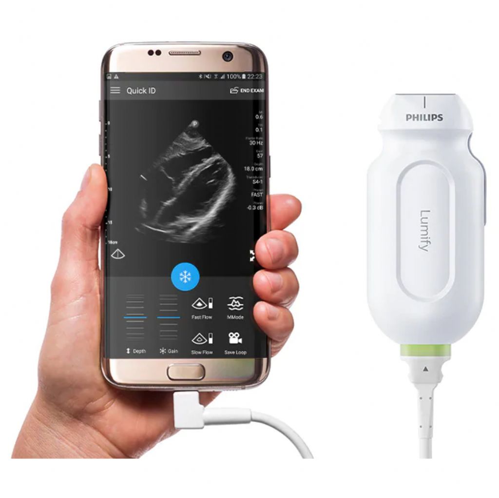 PHILIPS LUMIFY RENKLİ DOPPLER ULTRASON CİHAZI